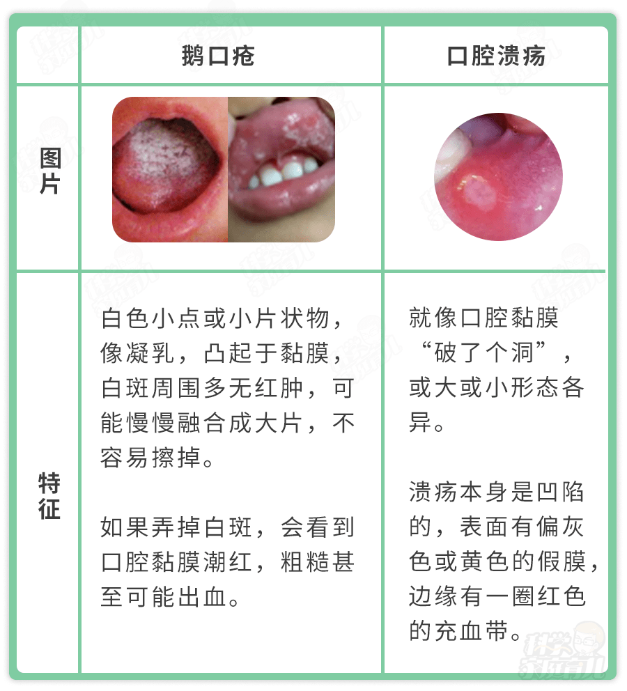 家长一个动作 娃嘴巴烂一片 3个习惯诱发鹅口疮 速查 每日头条